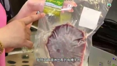 星期日檔案《乙肝共治》 2026/07/26